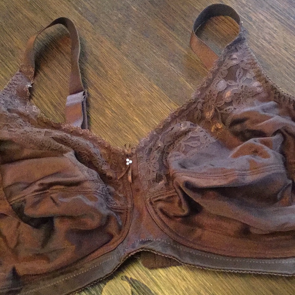 Amost U Mastectomy